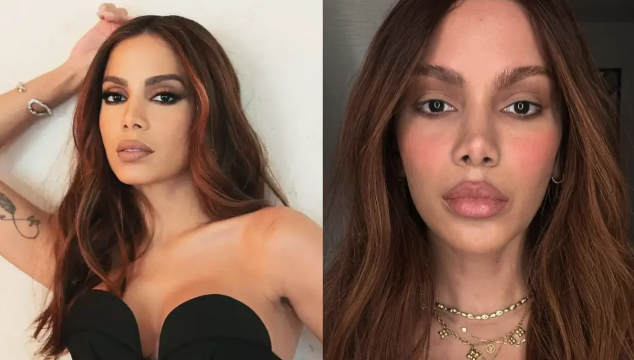Anitta se pronuncia sobre plásticas no rosto e disse que